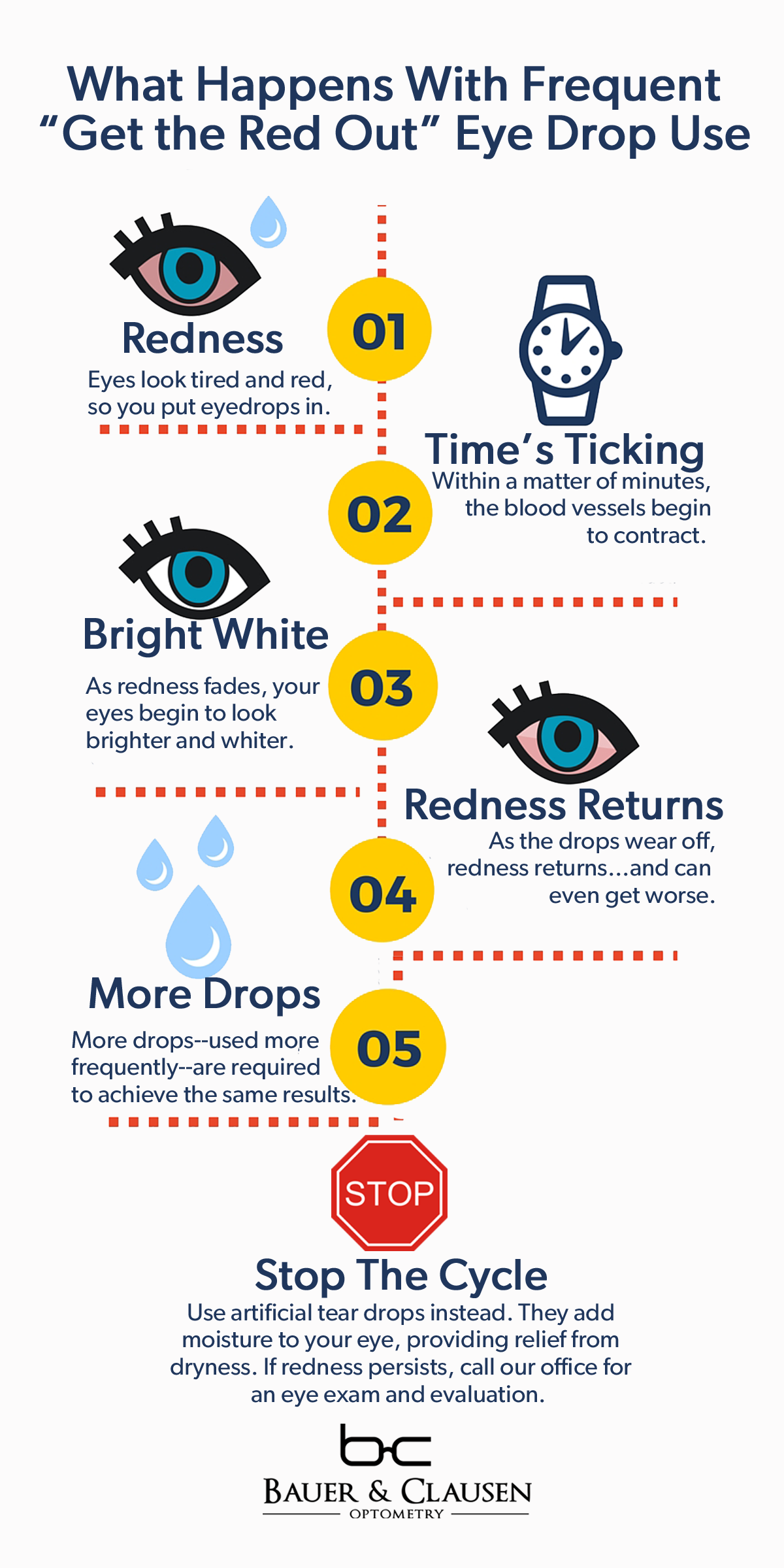 Eye Drops: Getting the Red Out | Choose the Right Eye Drops