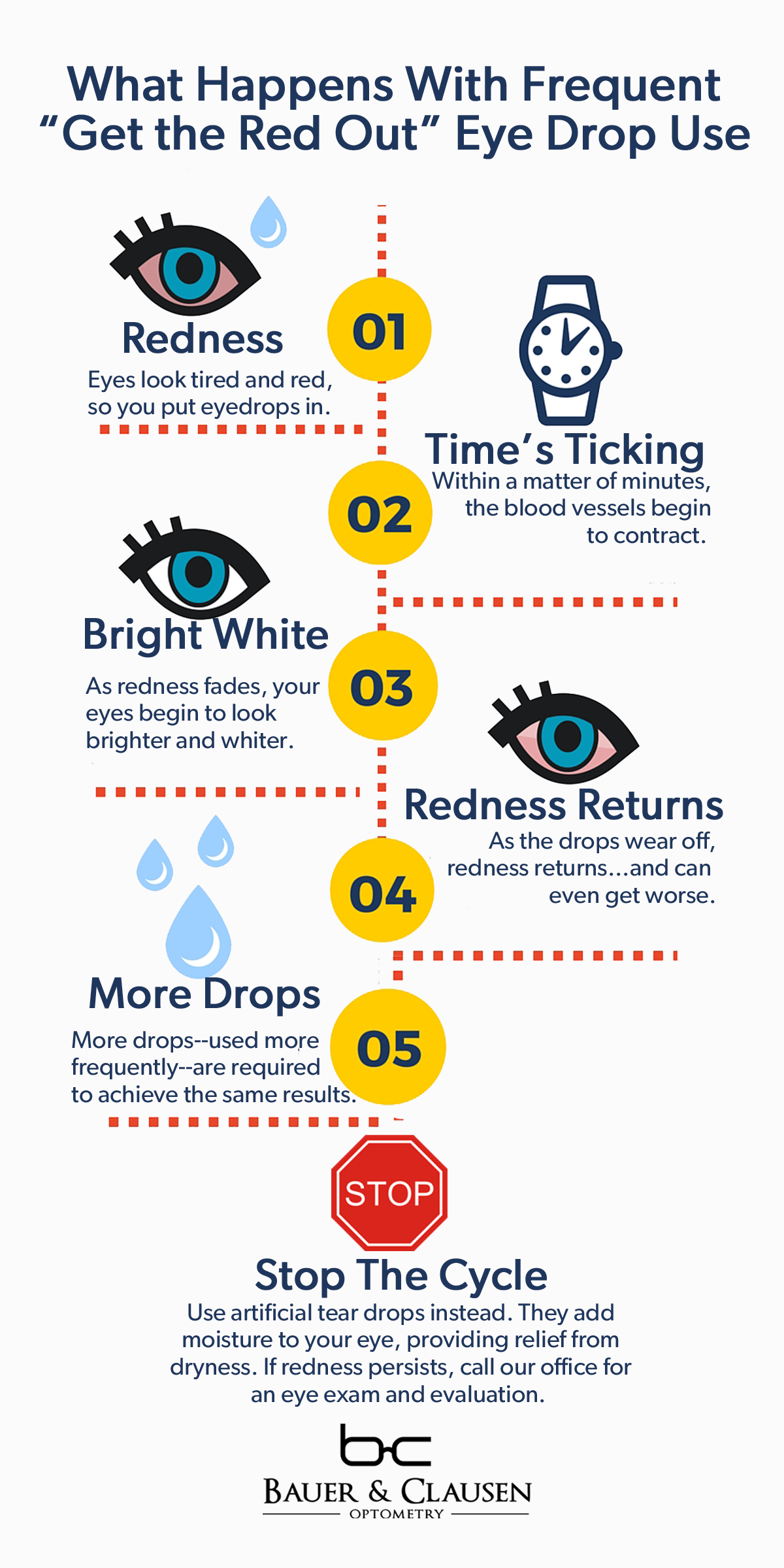 Eye Drops: Getting the Red Out