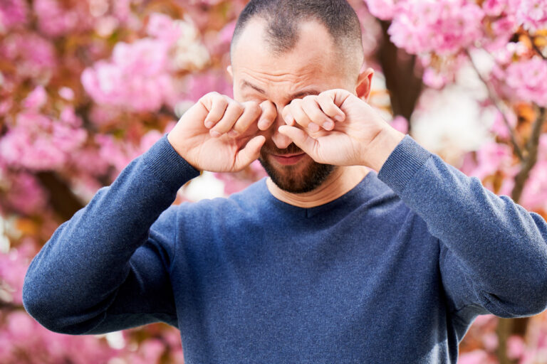 Common Eye Allergies 4 14 25 AH INSTA