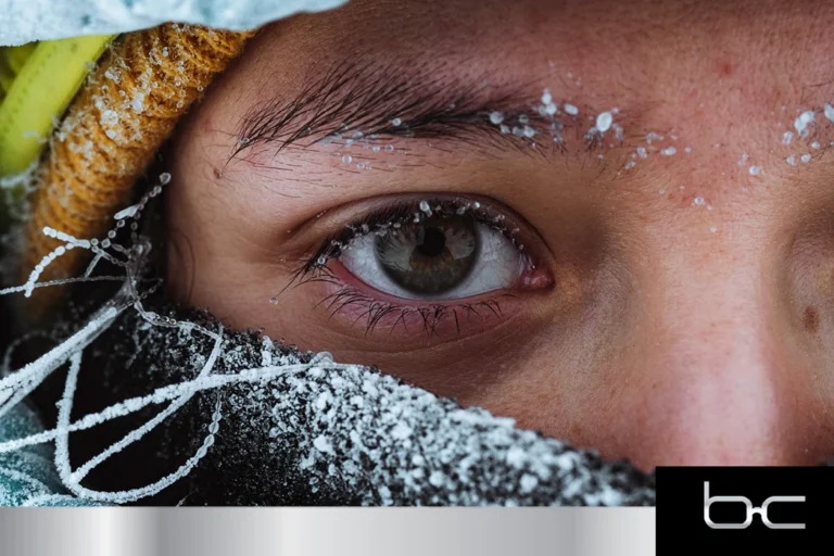 Understanding Snow Blindness